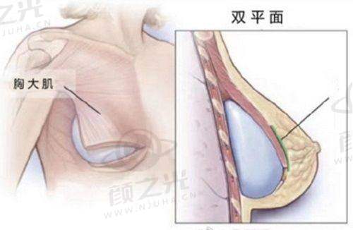 五、西安西美医院直腿术医生推荐