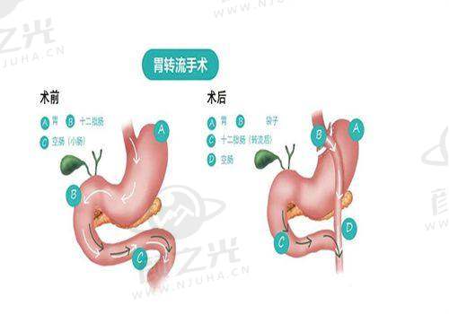 三、大连爱德丽格刘志刚之多眼皮修复实例