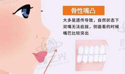 杨晓英预约挂号