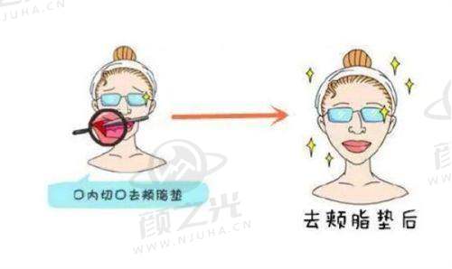王丽丹技术优势