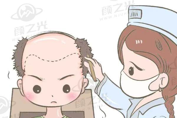 广州碧莲盛植发