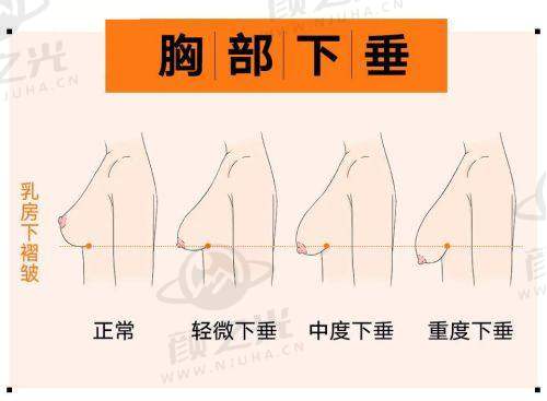 三、哈尔滨艺星医疗美容医院有哪些特色项目？