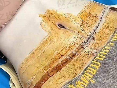 二、广州碧莲盛植发医院概况揭秘
