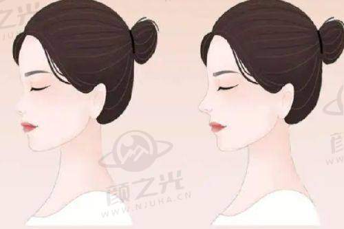 李洋预约挂号