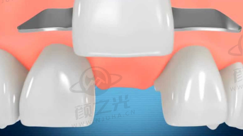 保定市精卓口腔的医生团队咋样？