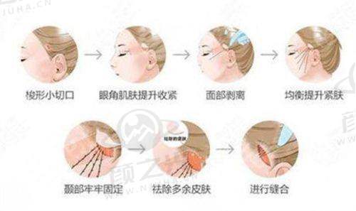 胡艺觉口碑评价及反馈内容