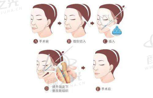 杨国梁技术优势