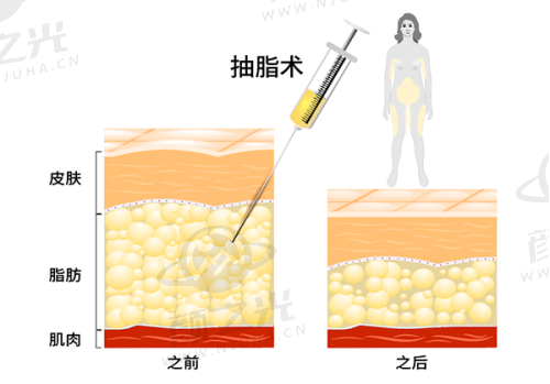 唐其科技术优势