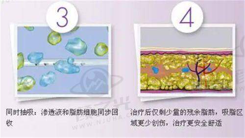 李丽丽预约挂号