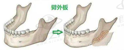 七、广州碧莲盛植发交通及周边情况