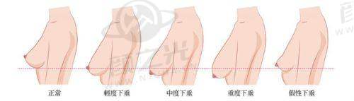 长沙雅美医疗美容医院怎么样？专家团队+特色项目+价格案例全揭秘！ 