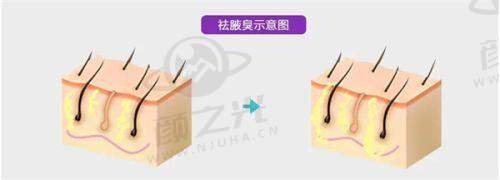 杭州天鑫医疗美容医院：热门项目技术亮点