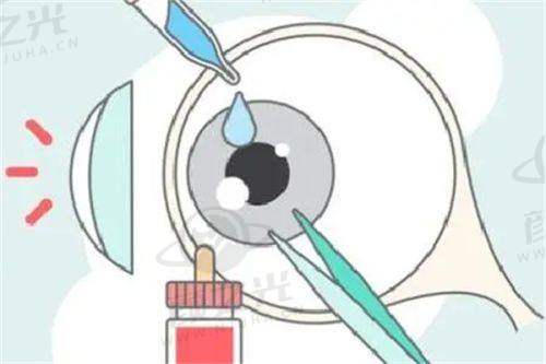 湖州艾目眼科专科团队强大