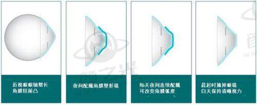 七、长沙博视眼科医院医生 - 卜继普