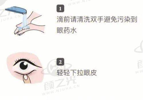 爱尔眼科医院预约挂号全攻略！从准备到就诊，各环节注意事项一文说清 