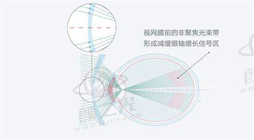 三、昆明红十字会眼科医院就诊全流程避雷指南
