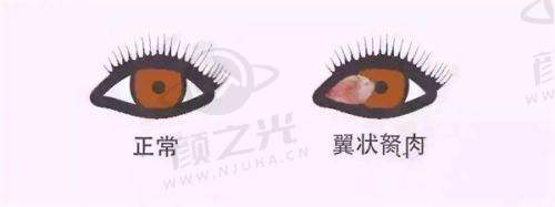 河源诗卓拉眼科诊所怎么样?2025年近视矫正价格及服务项目一览,附地址及口碑调查