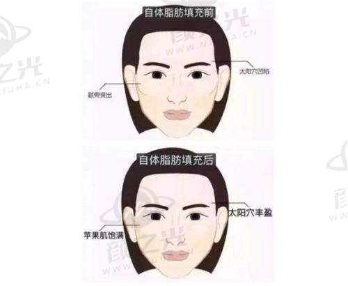李洋技术优势