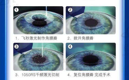 郑州郑东视献眼科门诊部