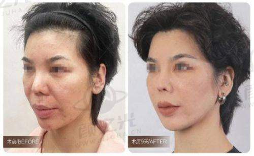 安徽芜湖名姝医疗美容医院之精良技术与设备及周边配套