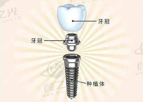 四、南京英博口腔特色项目展示