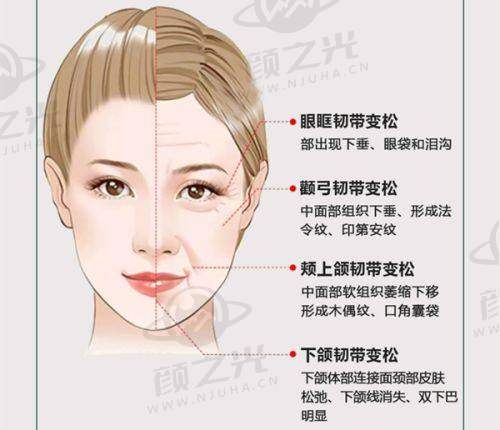 邢台遇见美整形怎么样？热门眼整形+脂肪填充优势揭秘，附成功案例 