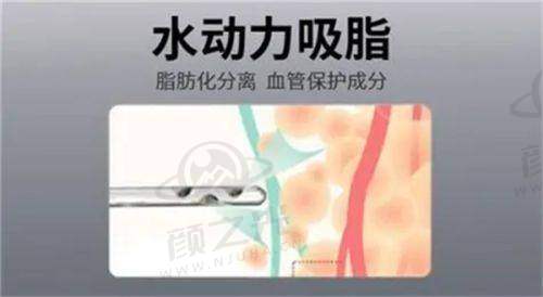 四、邢台遇见美整形成功实例