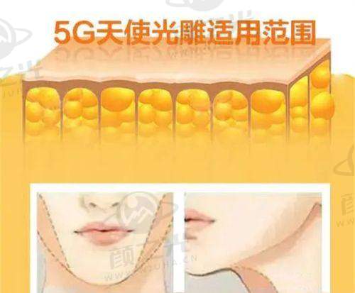 二、阳光医院植发科的靠谱性