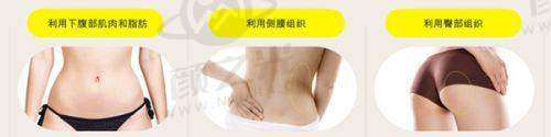 二、深圳美诗沁港丹医疗美容2025年价格表
