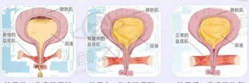 二、重庆医科大学附属第一医院激光美容科详情