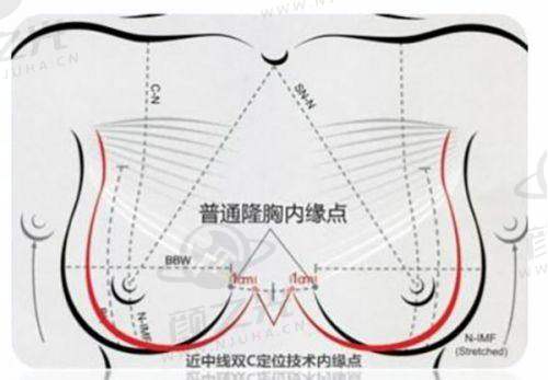 二、深圳宝丽医疗美容整形门诊部李信锋医生简介