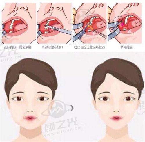 哈医大一院美容科 2025 版价格表公布！科室、医生、案例及项目价格全揭秘 