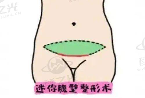 贵阳利美康整形医院技术设备
