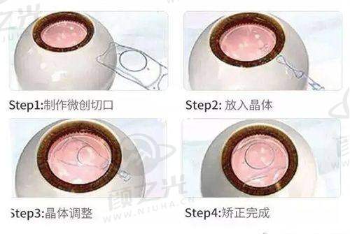 杭州黑马眼科到底好不好？全飞秒手术体验+专家团队揭秘，2025年近视矫正性价比之选