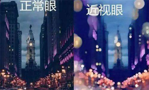 广州黄埔看眼科选哪家？爱尔眼科：王铮等名医坐诊，全飞秒价格亲民