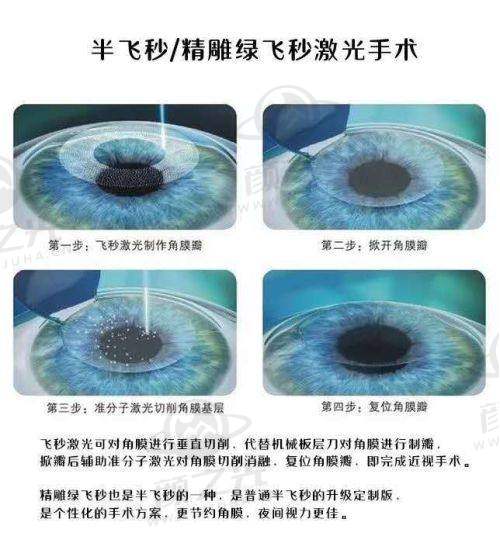 苏州光明眼科医院概况与优势
