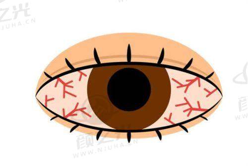 黄埔爱尔眼科是三甲医院吗？非三甲但靠谱！王铮医生坐诊，近视矫正 / 白内障治疗都专业