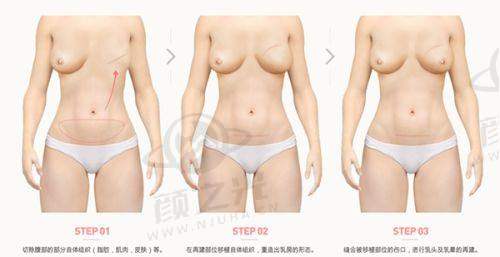 杭州艺星医疗美容医院用户评价怎么样？