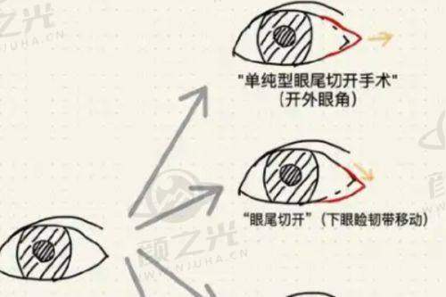二、中山大学附属第一医院——黎志明骨干医生