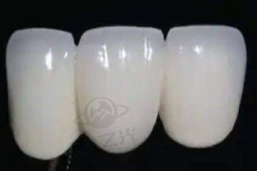 九江中山口腔医院牙齿矫正费用 6800 元起！多方案及优势揭秘，值得患者考虑！ 