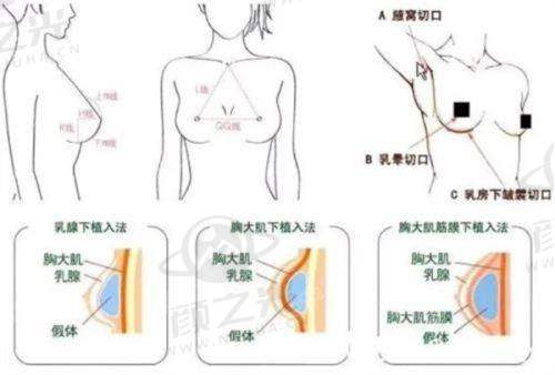 深圳艺星文丰医生15 年医美经验,擅长多项目,口碑好价格透明,速来预约!