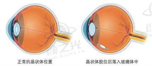 杭州艺星医疗美容医院综合情况值得信赖吗？