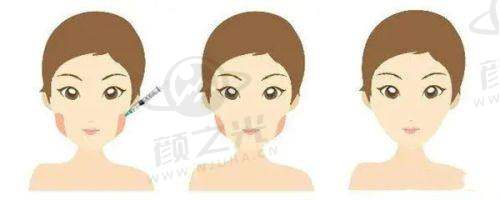 常德美莱整形医院诊疗项目是否丰富？