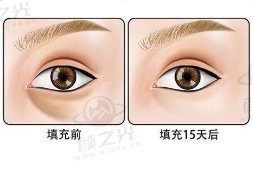 沈阳元辰整形医院有哪些优势项目？