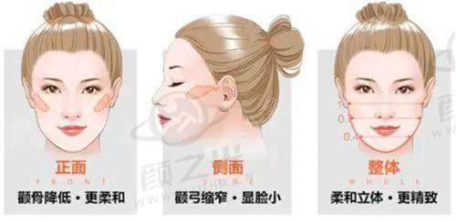 东莞美立方整形医生在面部整形领域表现怎样？