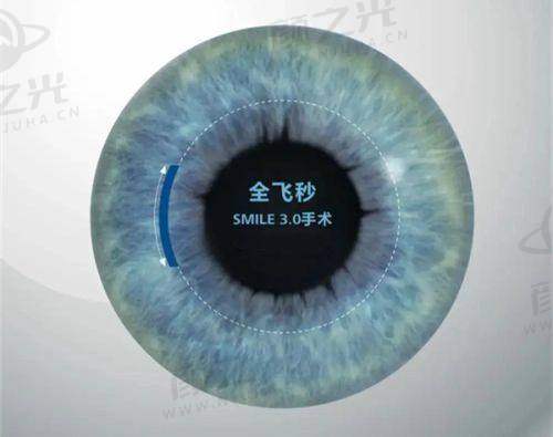 三、西安市第四 医院眼科急诊服务详情