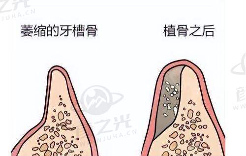 杭州天鑫整形医院吴艾竞医生:韩式微创双眼皮具有影响力