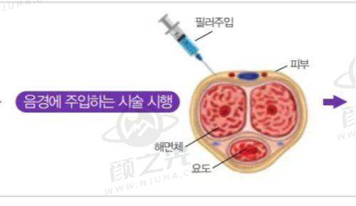 南昌国丹植发医院技术与经营正规吗？