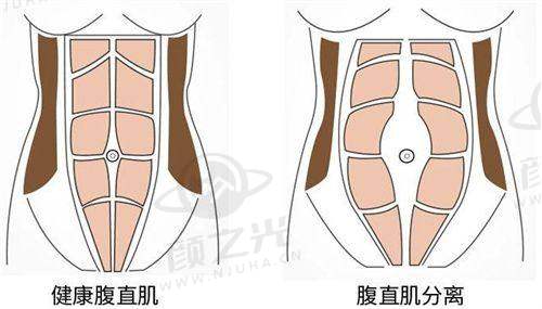 北京艺美巩敏医生的招牌技术