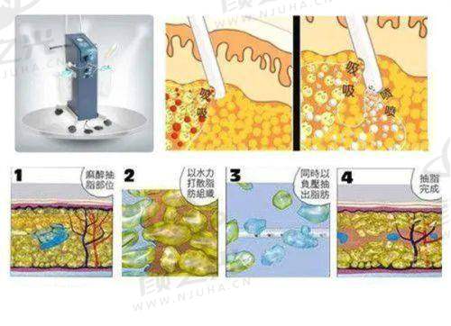 宿州柏羽医疗美容纪先佳医生：眼修复领域佼佼者